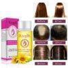 Hair Growth Essential Oil BEAUTY & SKIN CARE Body Lotion & Oil Hair Care bd7a9717d29c5ddcab1bc1: 20 ml / 0.68 oz