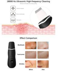 Rechargeable Blackhead Removal Tool BEAUTY & SKIN CARE LED Wedding Balloons WEDDING & GIFTS cb5feb1b7314637725a2e7: Black|Milk White 