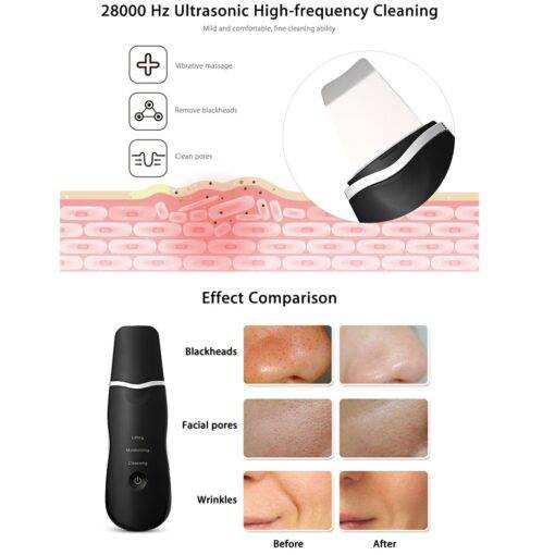 Rechargeable Blackhead Removal Tool BEAUTY & SKIN CARE LED Wedding Balloons WEDDING & GIFTS cb5feb1b7314637725a2e7: Black|Milk White